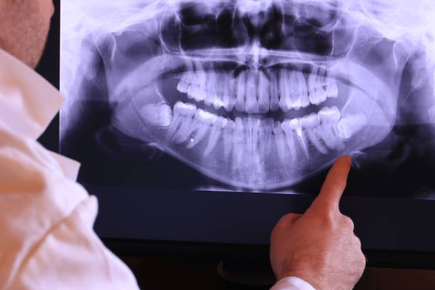 Professional Emergency Dental Service in MD